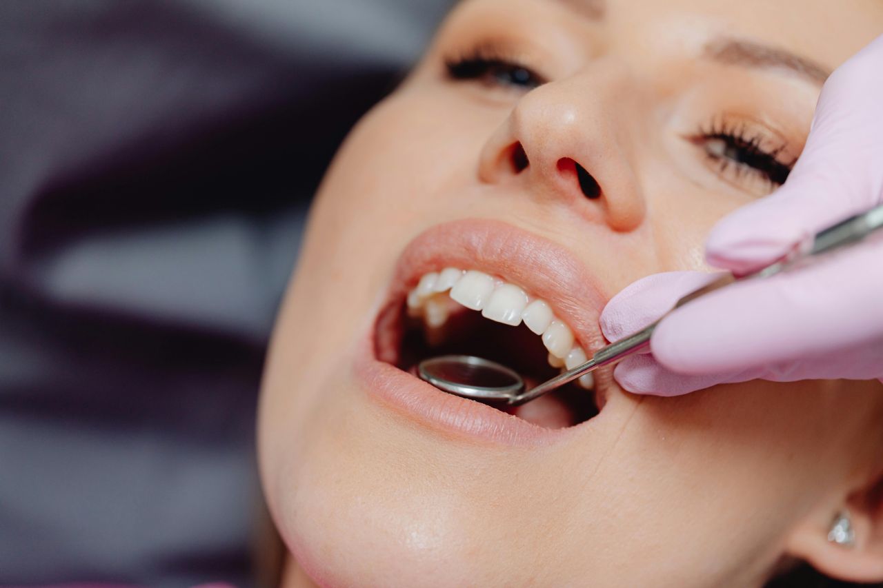Ho sofferto di disturbi alimentari, &egrave; per questo che i miei denti sono cos&igrave; fragili?